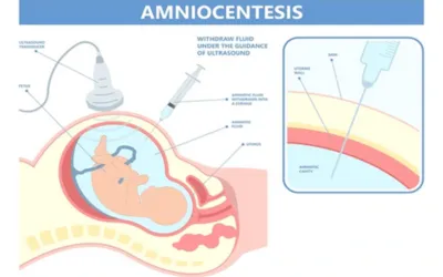 Ankle_Arthroscopy