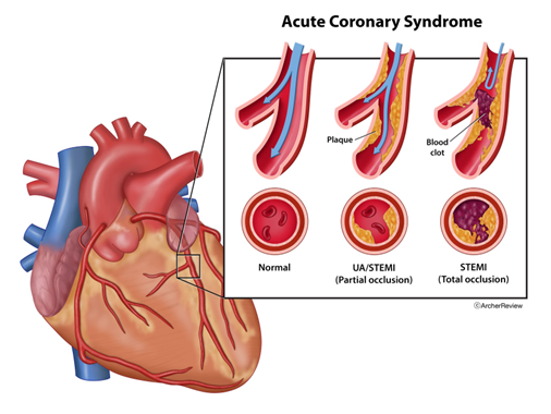 ACL Treatment in Mahishadal
