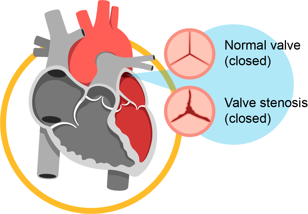 ACL Treatment in Mahishadal