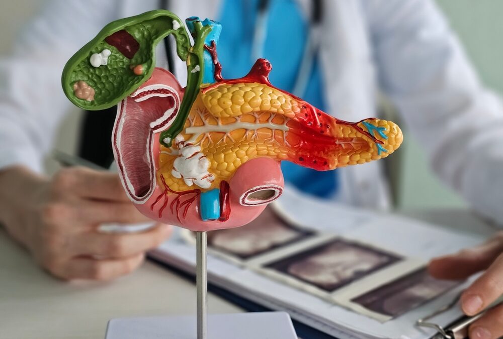 Do gallstones always need surgery