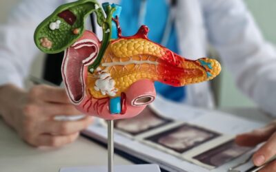 Do Gallstones Always Need Surgery?